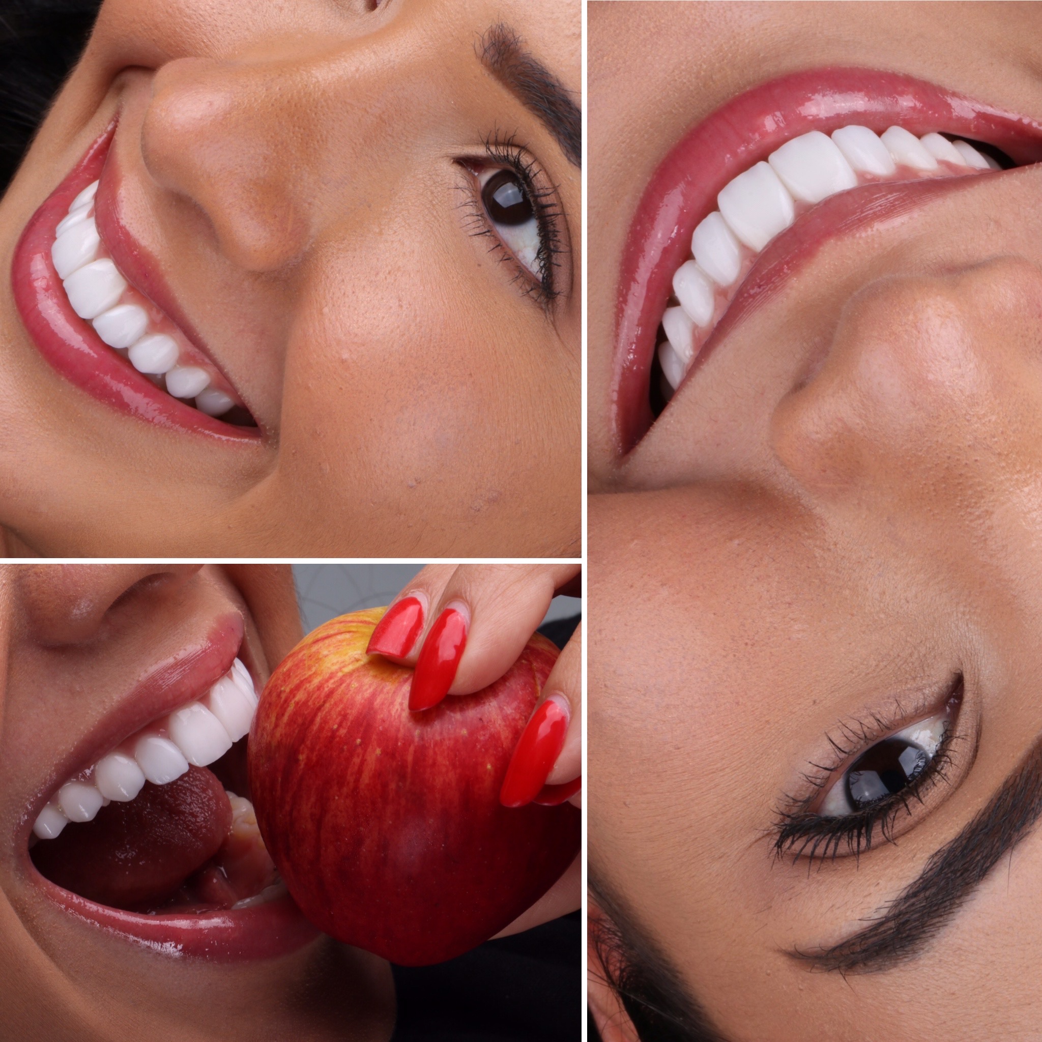 10-lentes-de-contato-dental.jpg